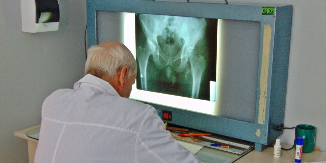 8 ноября – день рентгенолога